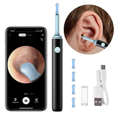 IGNITE™  - PROFESSIONAL EAR WAX REMOVAL TOOL